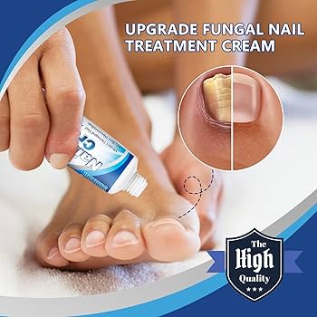 Sumifun Nail Repair Cream – Anti-Fungal Nail Treatment & Damage Repair Formula for Healthy, Clear Nails