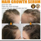 Biotin Hair Growth Serum by EELHOE - Anti-Hair Loss Treatment, Hair Thickening Serum, Strengthening & Revitalizing - 30ml