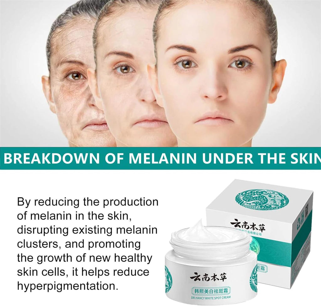 Japanese Melasma & Dark Spot Removal Cream – Dr. Hancy & Hoshi Whitening Herbal Formula (Yunnan Freckle Treatment)