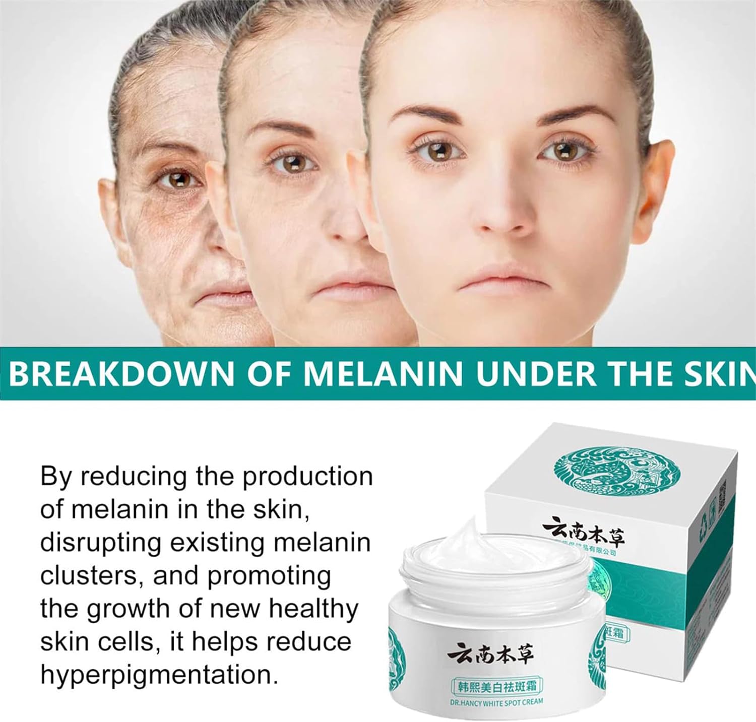 Japanese Melasma & Dark Spot Removal Cream – Dr. Hancy & Hoshi Whitening Herbal Formula (Yunnan Freckle Treatment)