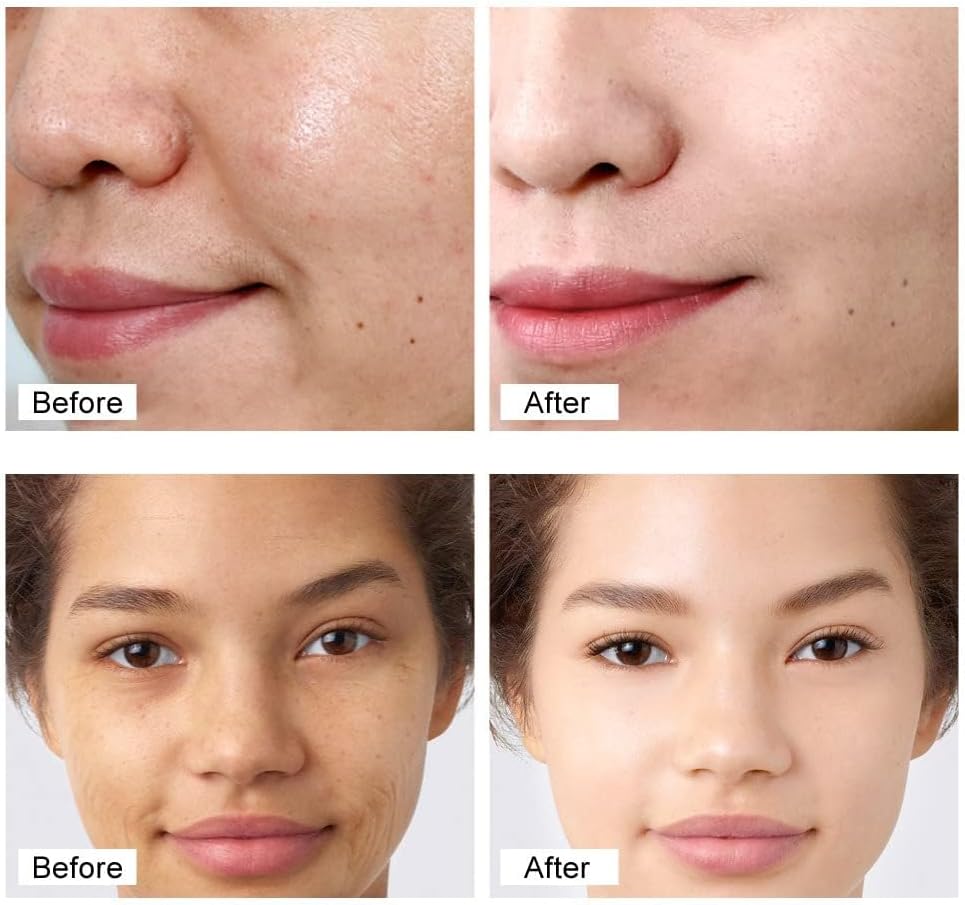 Retinol Face Cream – Whitening, Anti-Wrinkle & Deep Moisturizer for Dry Skin | Skin Firming & Rejuvenation