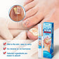 Sumifun Nail Repair Cream – Anti-Fungal Nail Treatment & Damage Repair Formula for Healthy, Clear Nails