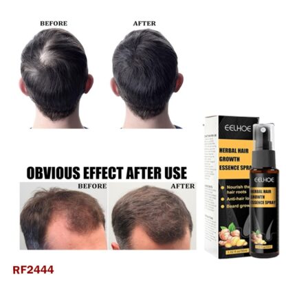 Hair Growth Essence Spray Set – Anti-Hair Loss Spray Oil for Stronger, Thicker, and Healthier Hair (30ml x 2)