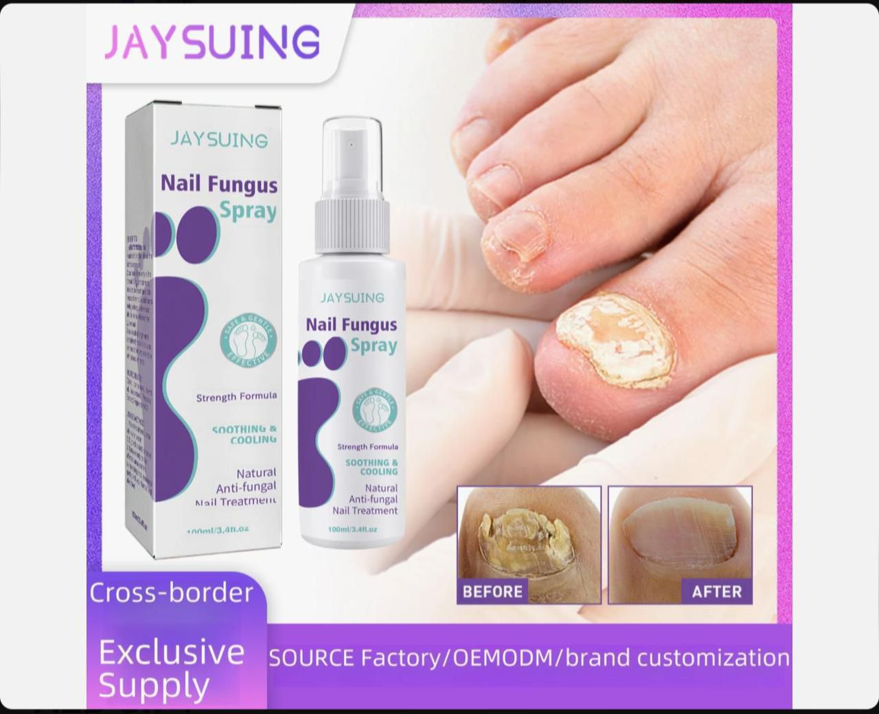 Jaysuing Nail Fungus Treatment Spray – Extra Strength Anti-Fungal Solution for Toenails and Fingernails – Restores Discolored, Thick, and Damaged Nails (100ml)