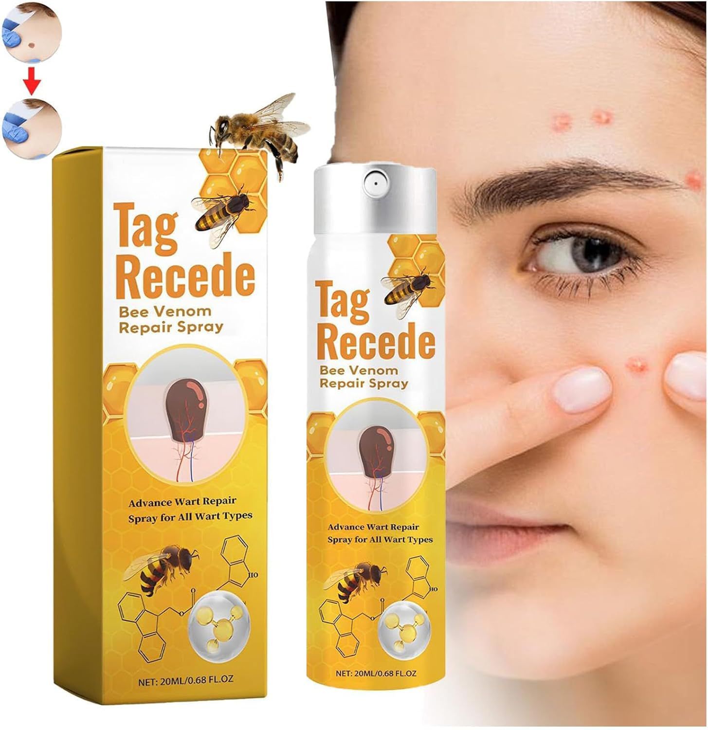 Tag Recede Bee Venom Repair Spray – Advanced Wart & Skin Tag Remover – Painless Fast-Acting Formula for All Wart Types and Skin Blemishes (20ml)