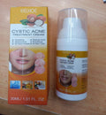 EELHOE Cystic Acne Treatment Facial Cream - Deep Hydrating & Skin Smoothing Acne Cream - 1.01 FL. OZ