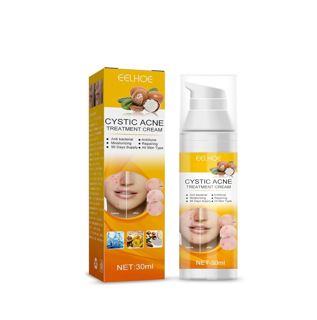EELHOE Cystic Acne Treatment Cream – Anti-Acne, Hydrating & Moisturizing Formula for Clear, Smooth Skin (30ml)